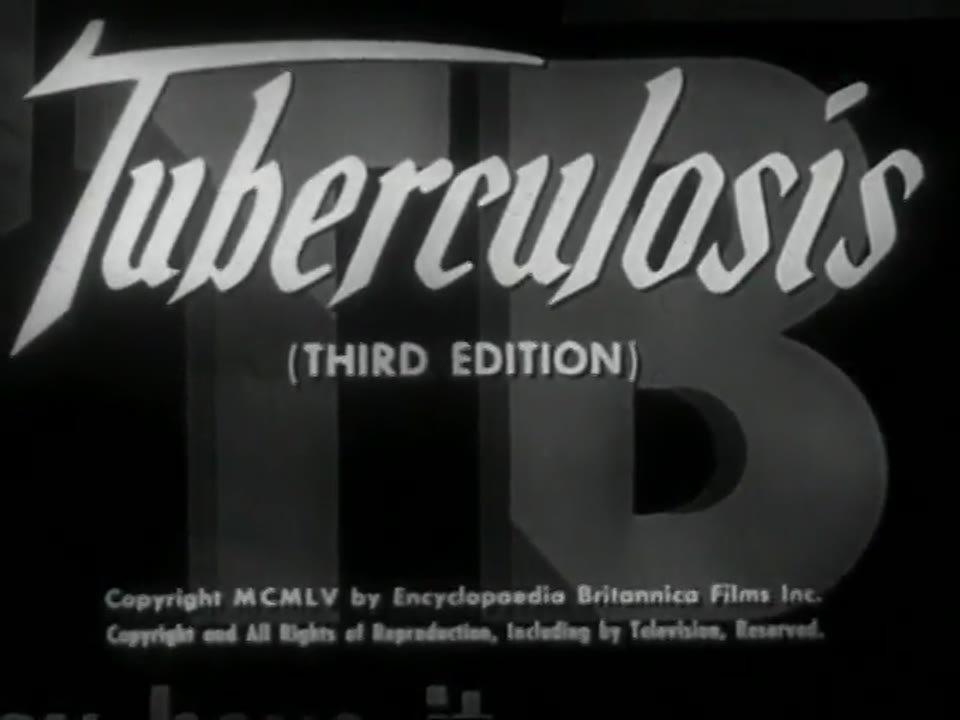 Tuberculosis (Third Edition)